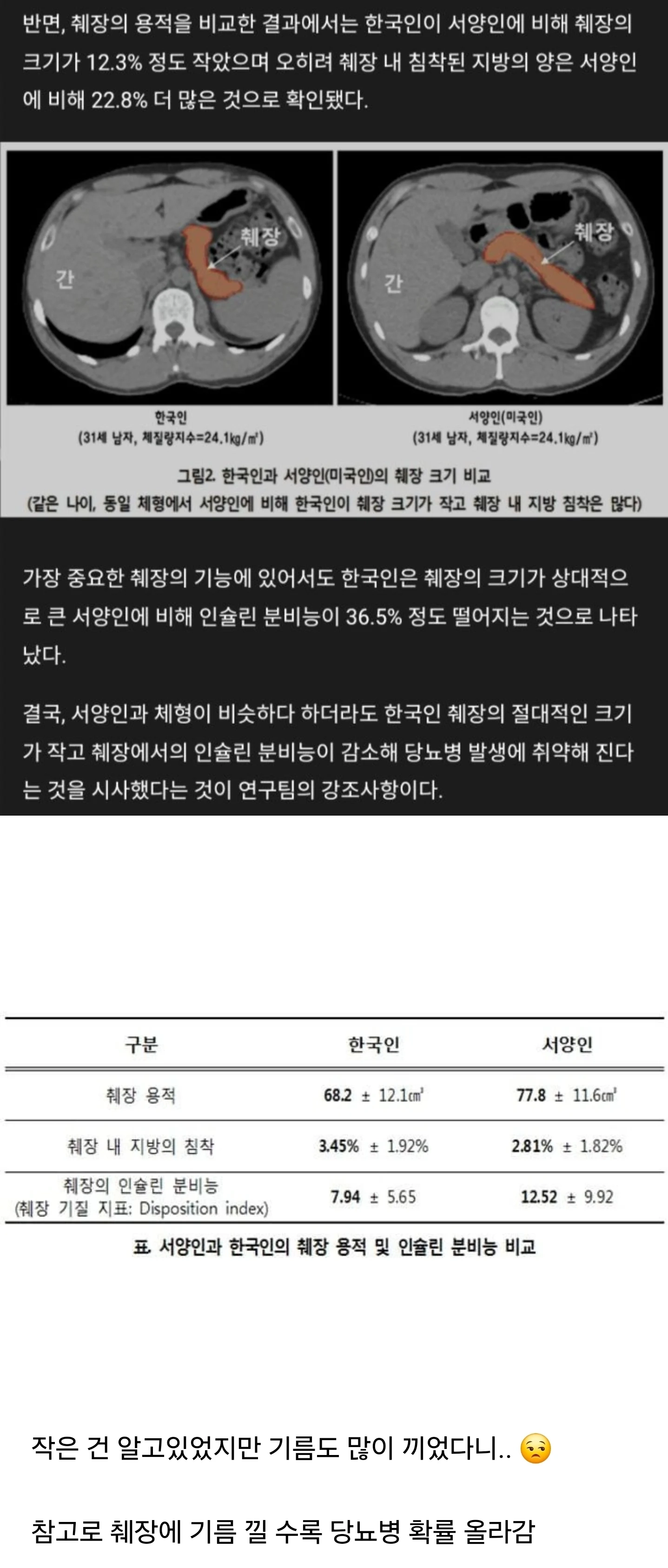 생각보다 작고 소중한 한국인 췌장.jpg