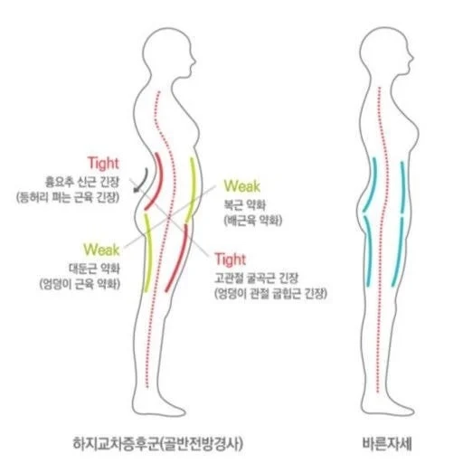 코어 근육 없는 사람 특징.jpg